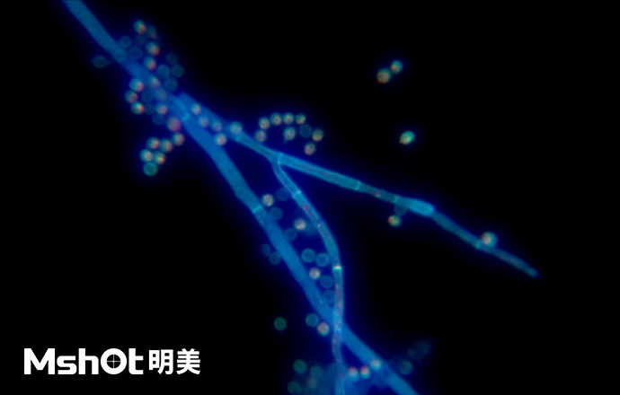 熒光生物顯微鏡下的黃曲霉？
